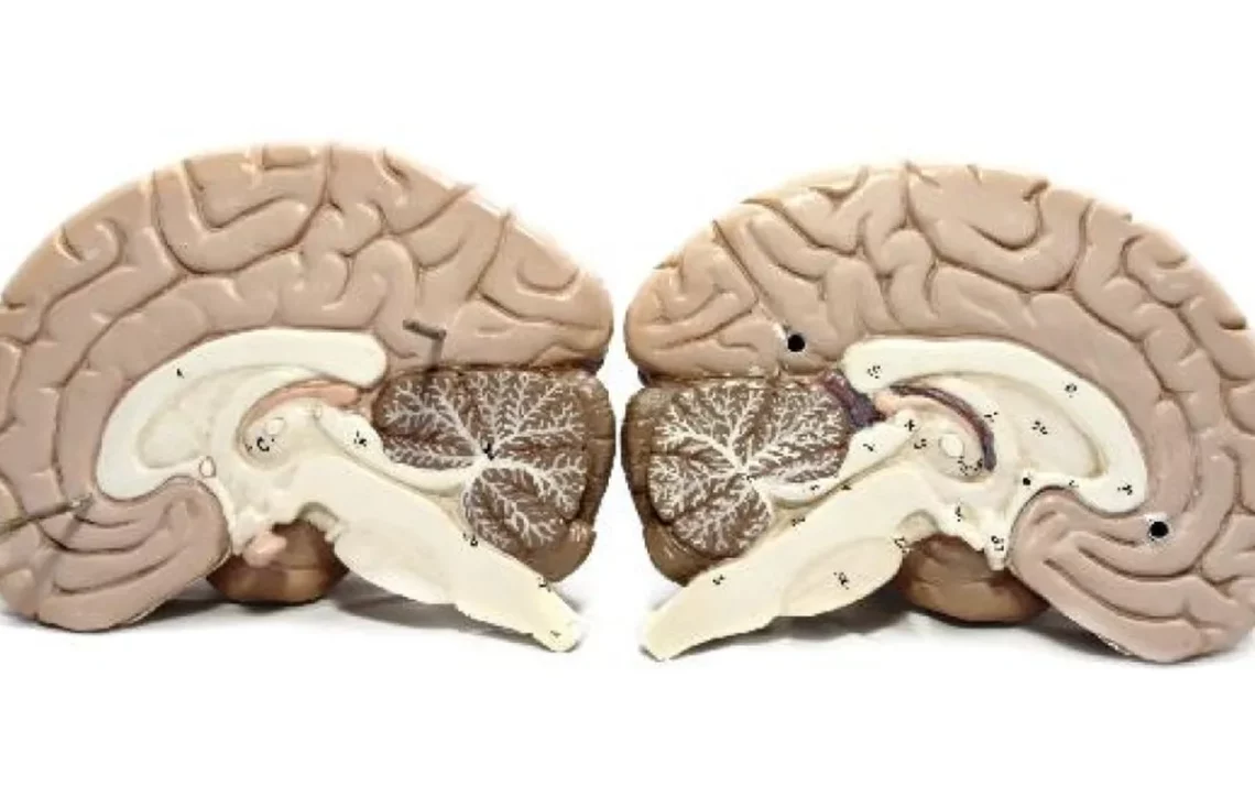 glioma, tumor, cerebral, DNA, tumoral;