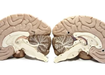 glioma, tumor, cerebral, DNA, tumoral;